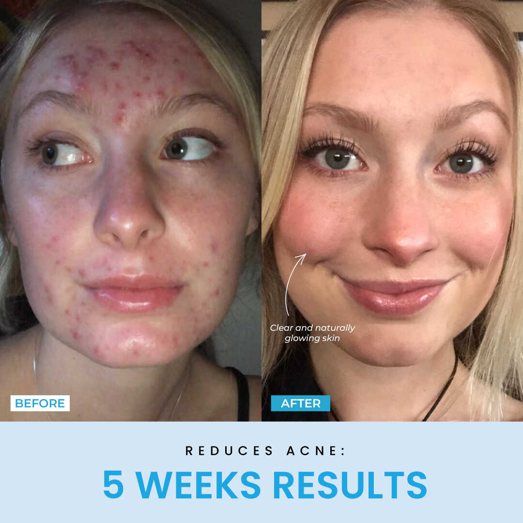 Beauty Glow Up - Lift Face