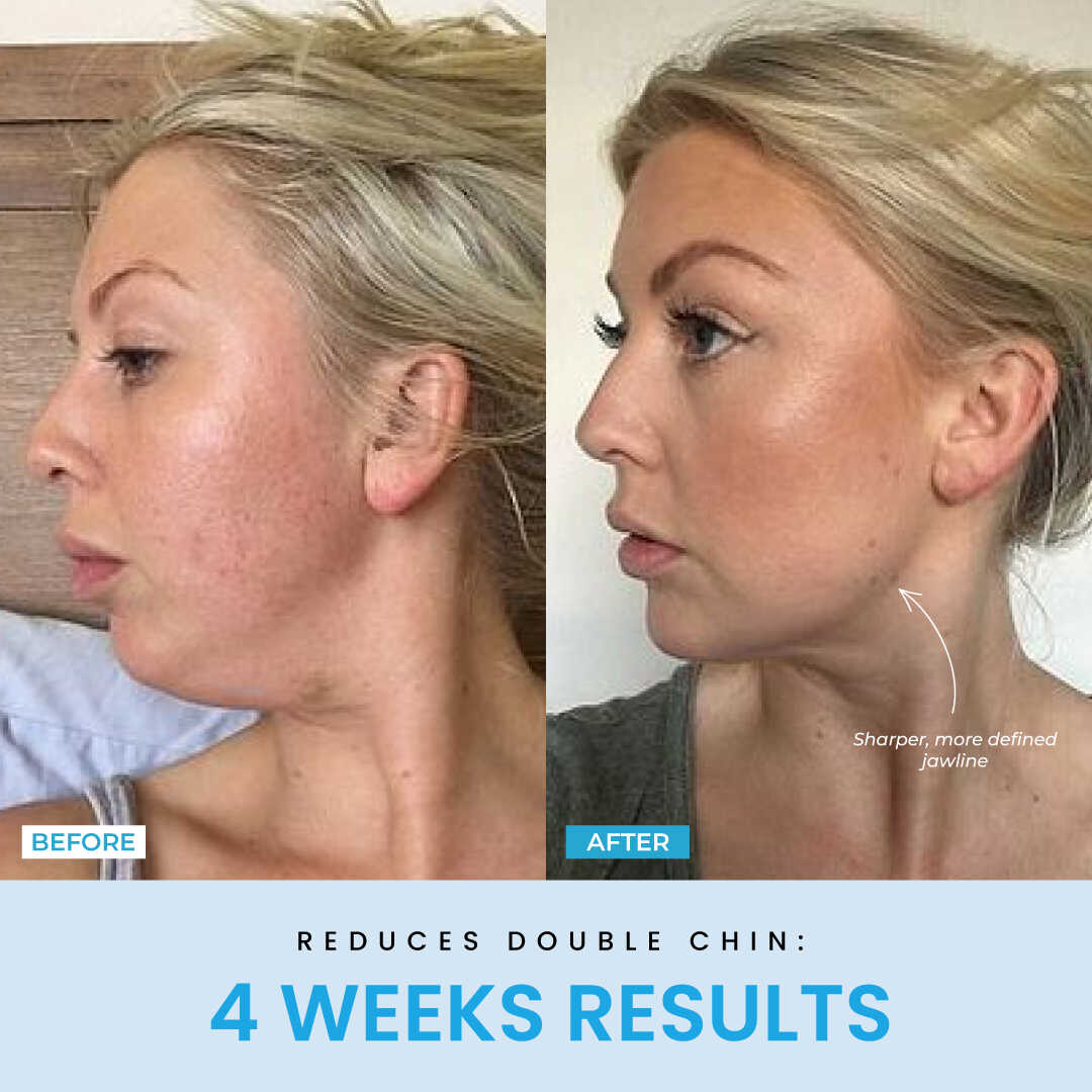 Beauty Glow Up - Lift Face