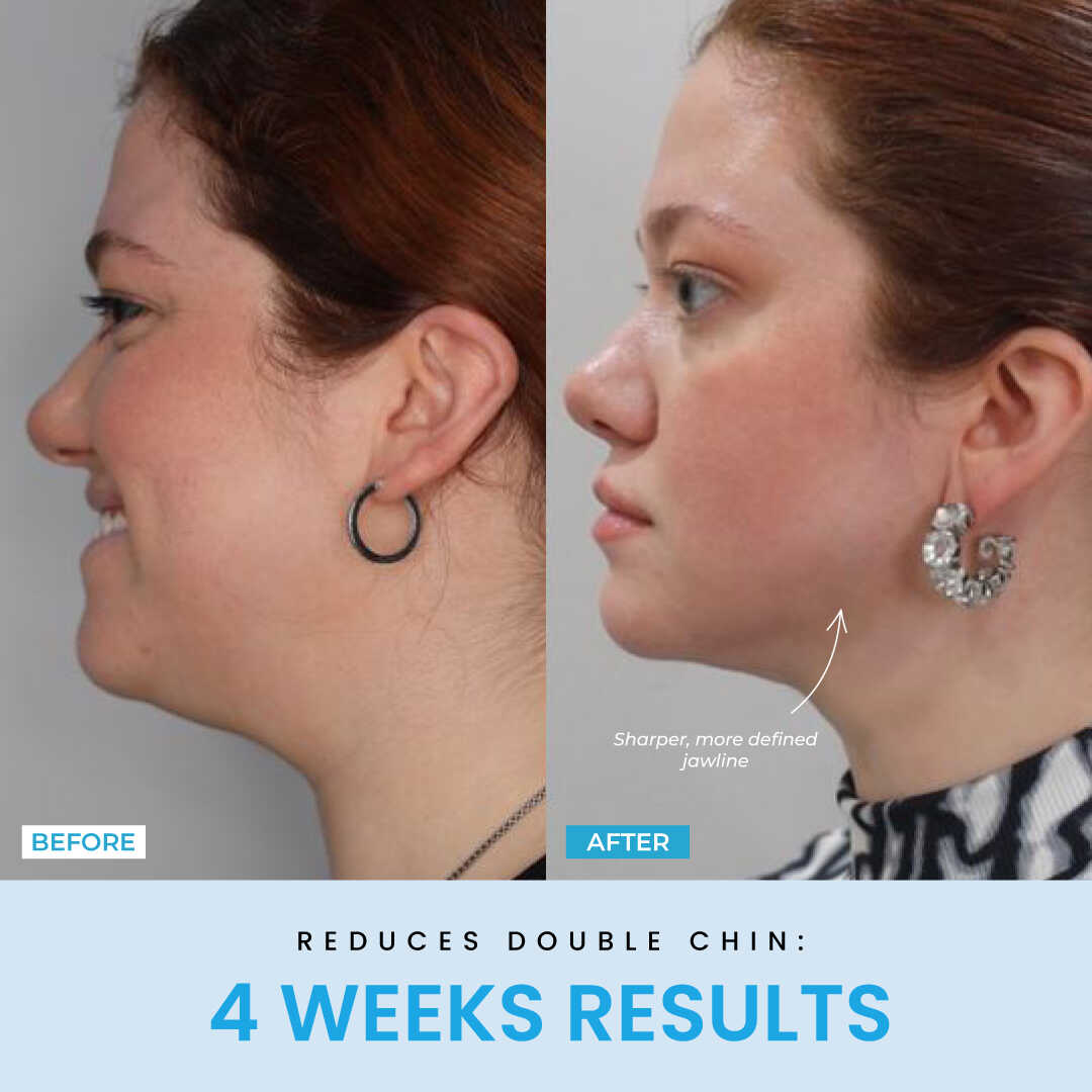 Beauty Glow Up - Lift Face