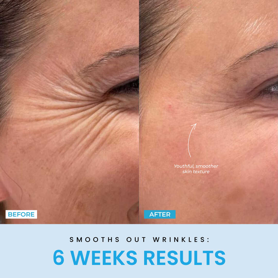 Beauty Glow Up - Lift Face