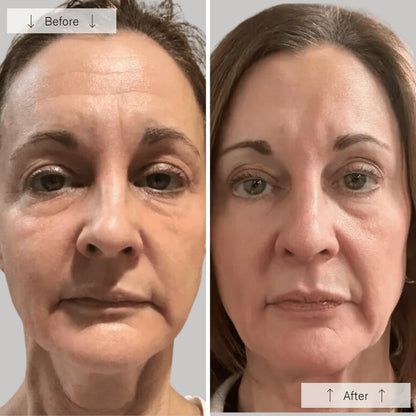 LED Light Therapy Face Mask Anti-Aging