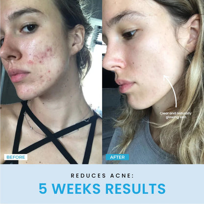 Beauty Glow Up - Lift Face