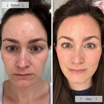 LED Light Therapy Face Mask Anti-Aging