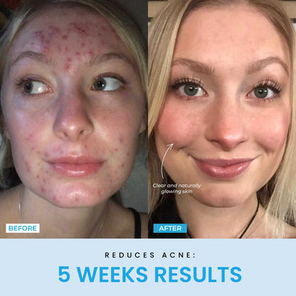 Beauty Glow Up - Lift Face