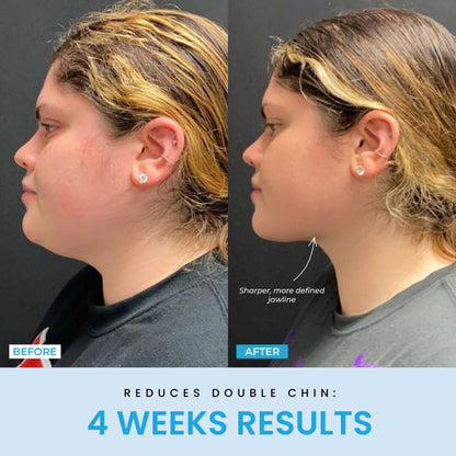 Beauty Glow Up - Lift Face