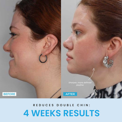 Beauty Glow Up - Lift Face