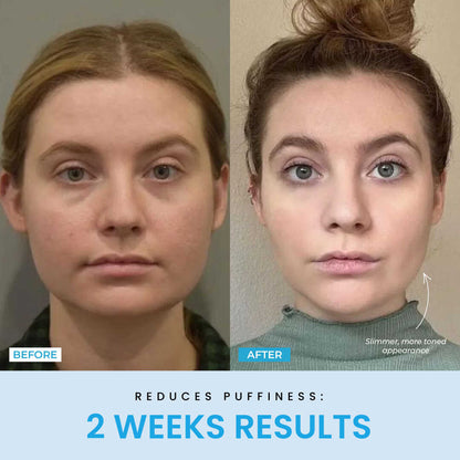 Beauty Glow Up - Lift Face