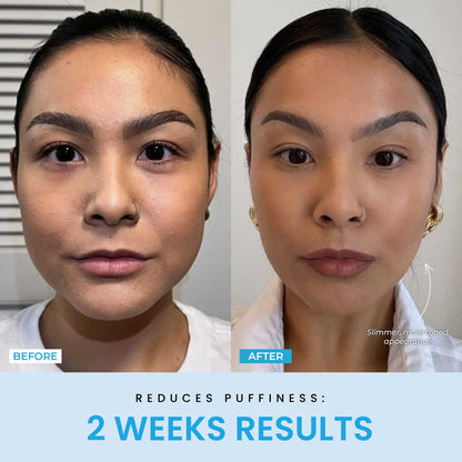 Beauty Glow Up - Lift Face