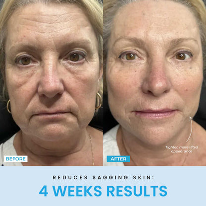 Beauty Glow Up - Lift Face