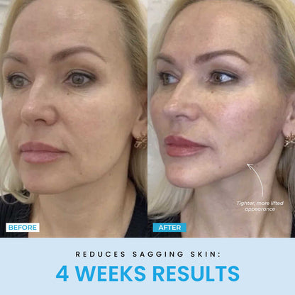 Beauty Glow Up - Lift Face
