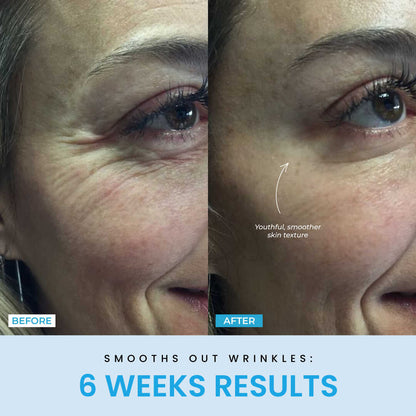 Beauty Glow Up - Lift Face