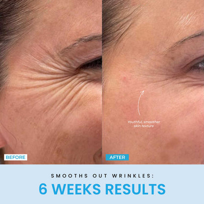 Beauty Glow Up - Lift Face