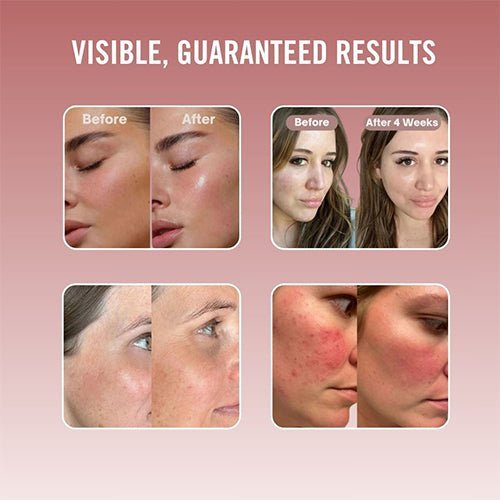 Bio-Collagen Mask